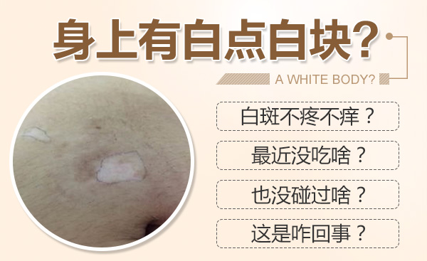 合肥華研白癜風醫院，白癜風預防